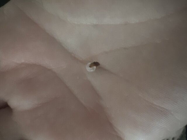 Kim C. skin tag result